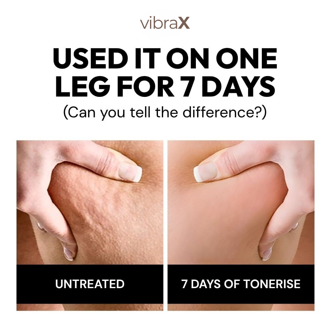Vibrax Anti-Cellulite Roller