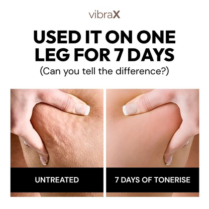 Vibrax Anti-Cellulite Roller